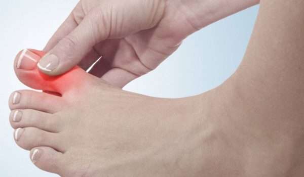 النقرس.. أعراضه وأسبابه وطرق العلاج والوقاية منه