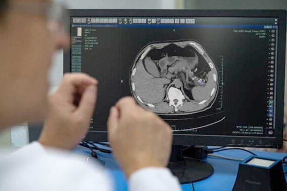 «باندا» الذكية تتفوق على الأطباء!